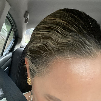 Gebruiker met Snugwear verwarmde schouder- en nekcape