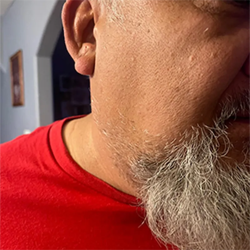 Utilisateur rasant son cou avec l'iTurbo Pro