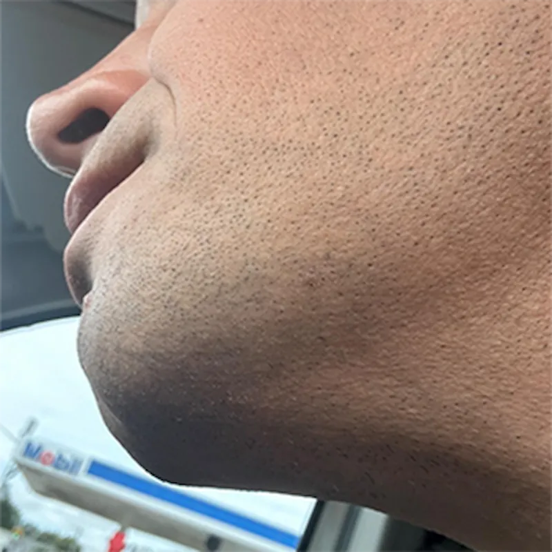 Nettoyage facile des lames de l'iTurbo Pro