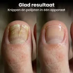 nailsonic-gallery3